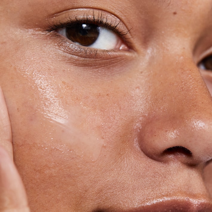 Avène Pelle grassa a tendenza acneica