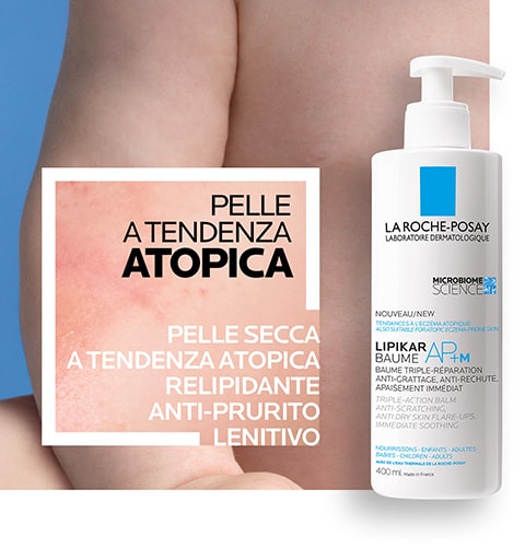 Pelle a tendenza atopica