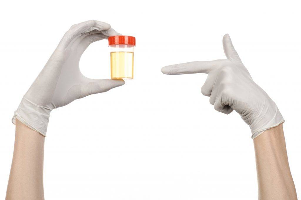 Contenitori sterili per analisi di urine e feci