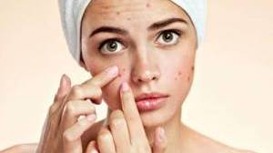 Viso con acne: ecco come detergerlo al meglio