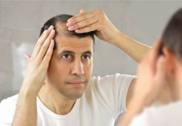 Alopecia: cause, rimedi e prodotti utili